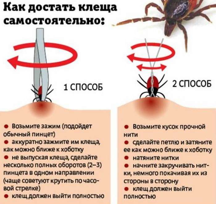 Как правильно удалить клеща в домашних условиях? Три способа